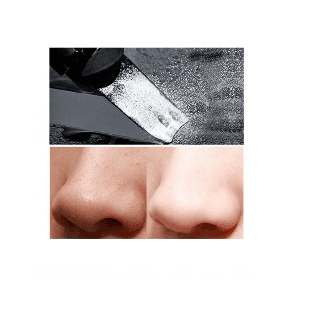 Xiaomi InFace cavitation face peeling - black